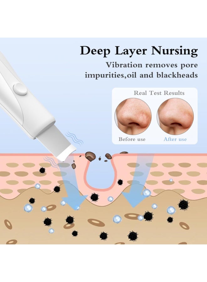Skin Scrubber Face Spatula – Ultrasonic Pore Cleaner & Blackhead Remover Tool for Deep Facial Cleansing, Rechargeable Skincare Device - Image 3